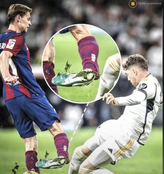 德国、法国等国队球员膝盖受伤的简单介绍 德国、法国等国队球员膝盖受伤的简单介绍